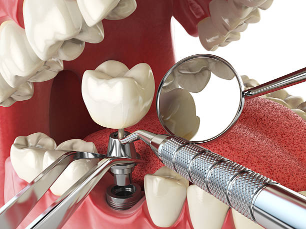 Best Walk-In Emergency Dentist in Tunica Resorts, MS