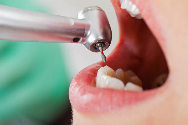 Best Emergency Broken Tooth Repair in Tunica Resorts, MS